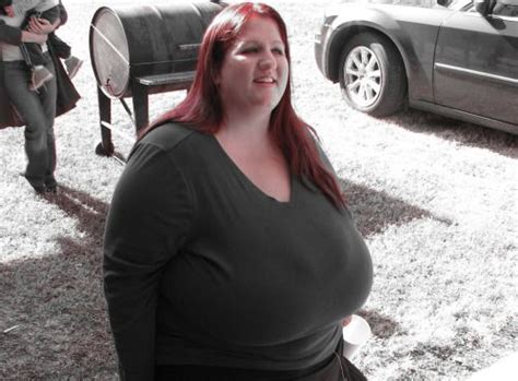 Breasts of burden: My battle with gigantomastia